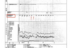 22岁美甲师手术成功却在复苏室脑死亡，家属称缺氧30分钟监护医生未察觉，医院回应