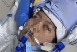 22岁美甲师手术成功却在复苏室脑死亡，家属称缺氧30分钟监护医生未察觉，医院回应